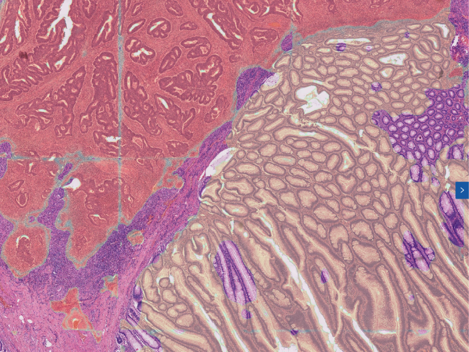 Cervical Biopsy Assistant Diagnostic Module​