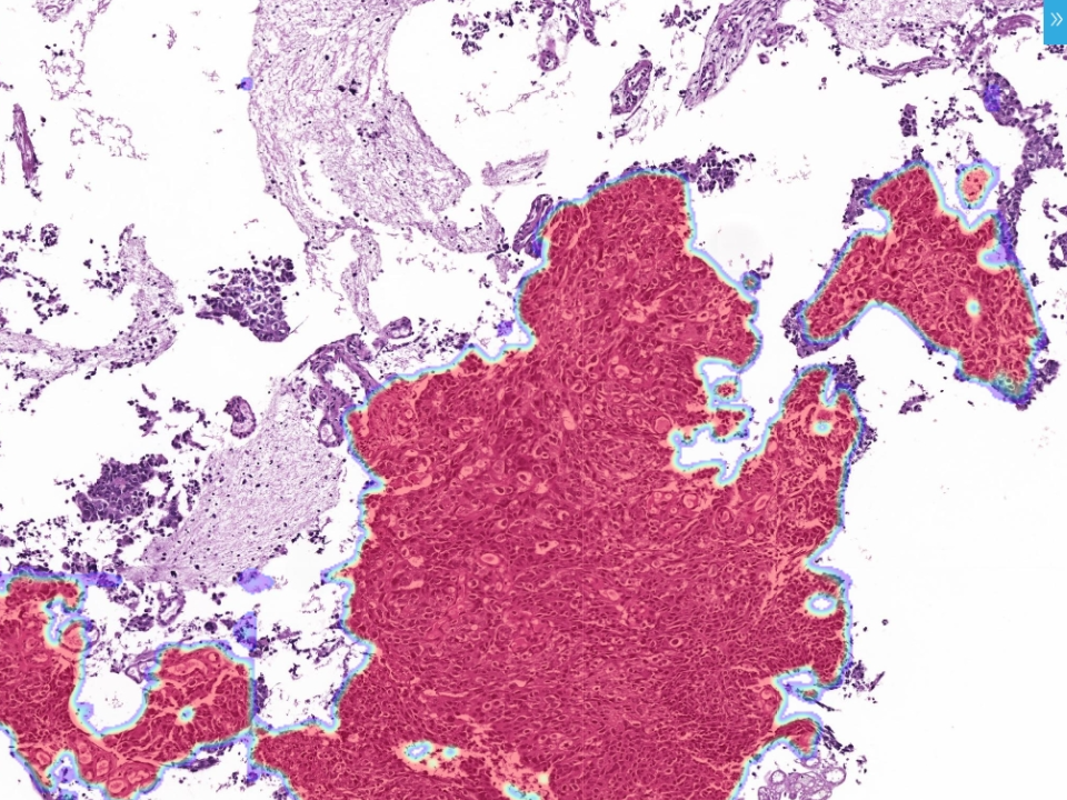 Endometrial Biopsy Assistant Analysis Module​