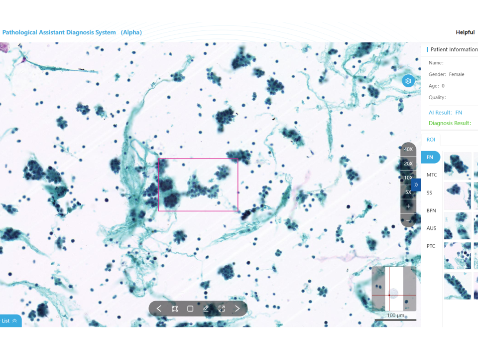 Thyroid Cytology Assistant Diagnostic Module​