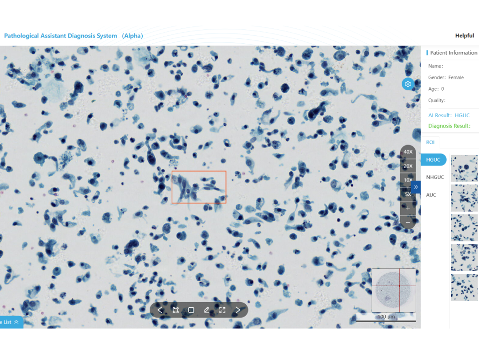 Urine Cytology Assistant Diagnostic Module​